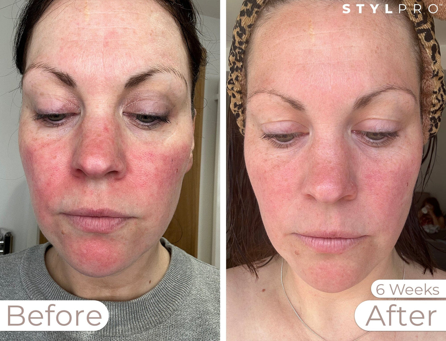 Radiant Complexion & Bright Eyes Bundle